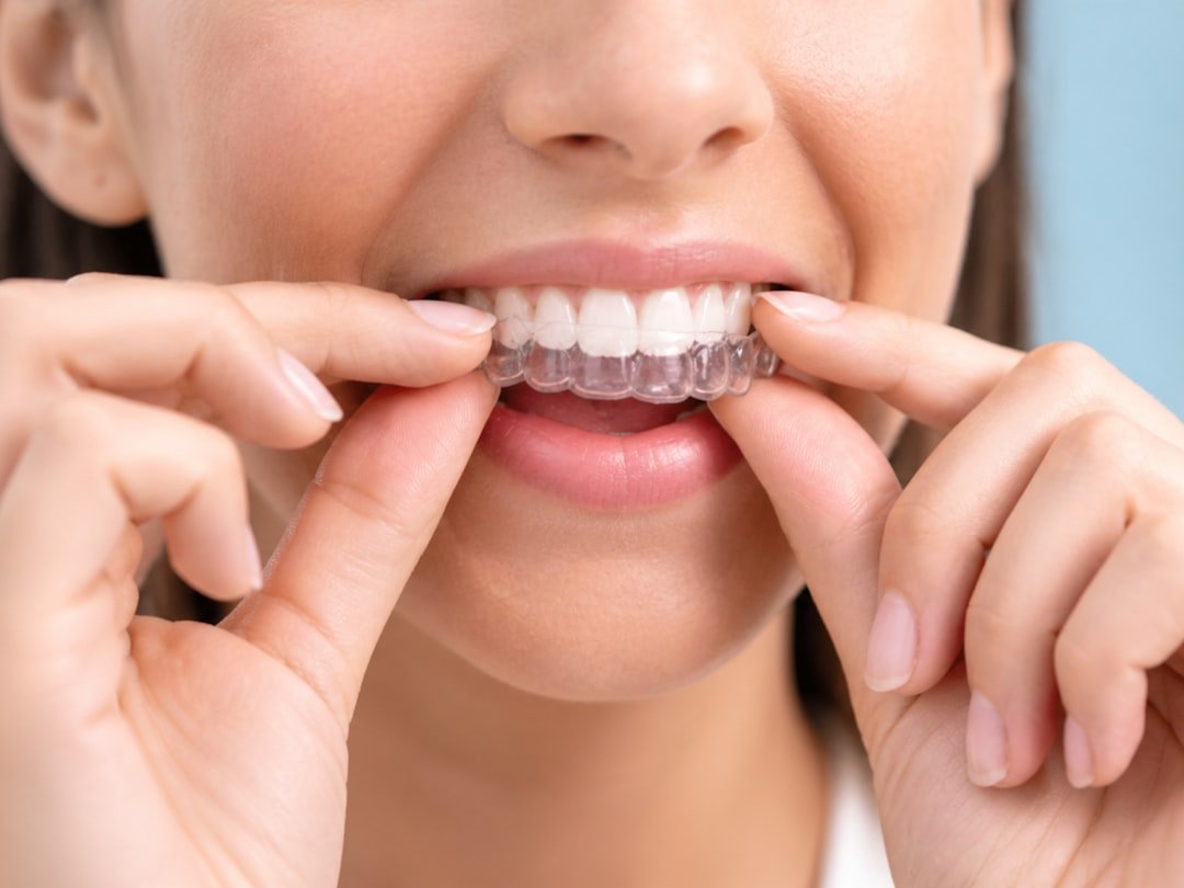 A bright close-up dental image showing a woman carefully fitting a transparent aligner onto her upper teeth. The clean bluish background, soft lighting, and sharp focus on the aligner make the image suitable for articles about clear aligners, Invisalign-style treatment, orthodontics, teeth straightening, and dental care.